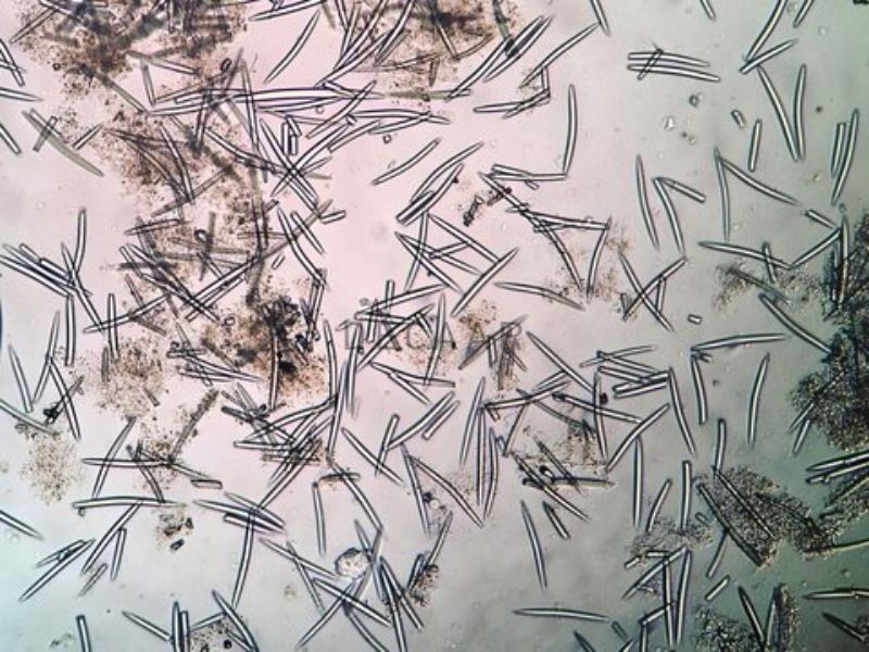 Lợi ích của Spicule Peeling
